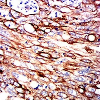 Cytokeratin 2 Mouse Monoclonal Antibody