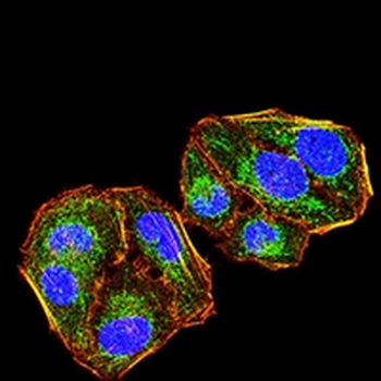 Cytokeratin 2 Mouse Monoclonal Antibody