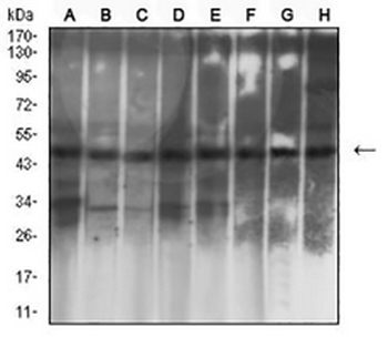 Cytokeratin 19 Mouse Monoclonal Antibody