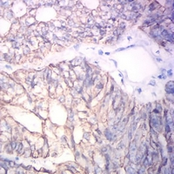Cytokeratin 19 Mouse Monoclonal Antibody