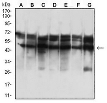 Cytokeratin 18 Mouse Monoclonal Antibody