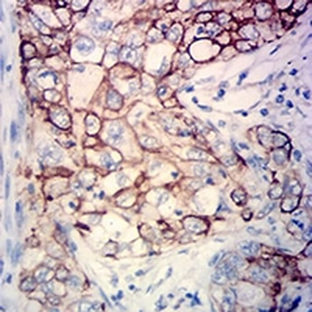 Cytokeratin 18 Mouse Monoclonal Antibody