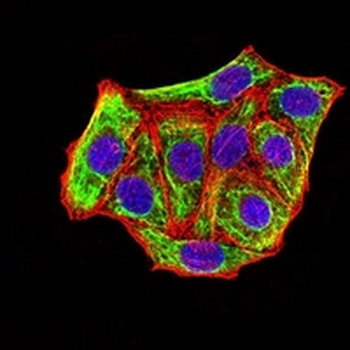Cytokeratin 18 Mouse Monoclonal Antibody