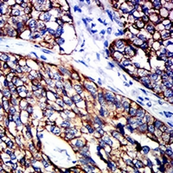 Cytokeratin 15 Mouse Monoclonal Antibody