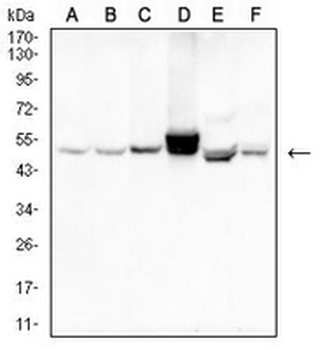 Cytokeratin 14 Mouse Monoclonal Antibody