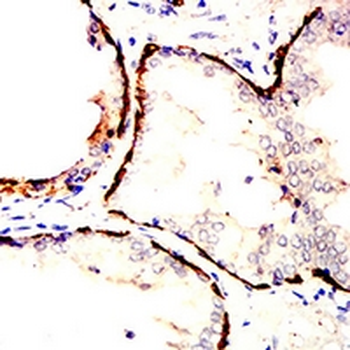 Cytokeratin 14 Mouse Monoclonal Antibody