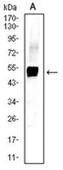 Cytokeratin 13 Mouse Monoclonal Antibody
