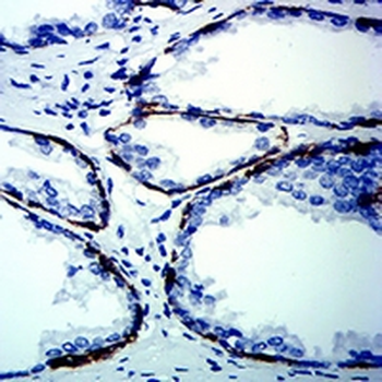 Cytokeratin 13 Mouse Monoclonal Antibody