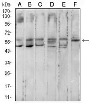 Cytokeratin 10 Mouse Monoclonal Antibody