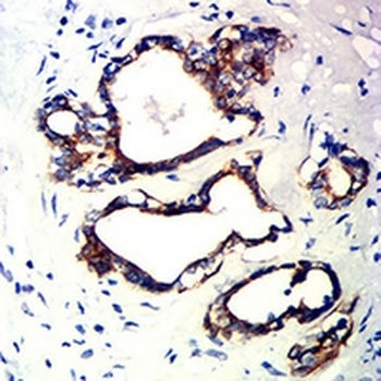 Cytokeratin 10 Mouse Monoclonal Antibody