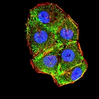 Cytokeratin 10 Mouse Monoclonal Antibody