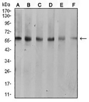 Cytokeratin 10 Mouse Monoclonal Antibody