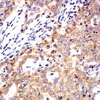 Cytokeratin 10 Mouse Monoclonal Antibody