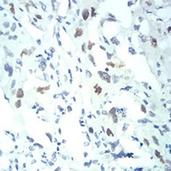 Importin alpha 2 Mouse Monoclonal Antibody