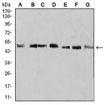 LKLF Mouse Monoclonal Antibody