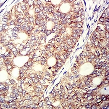 CD158e Mouse Monoclonal Antibody