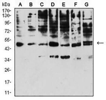 CD158e Mouse Monoclonal Antibody