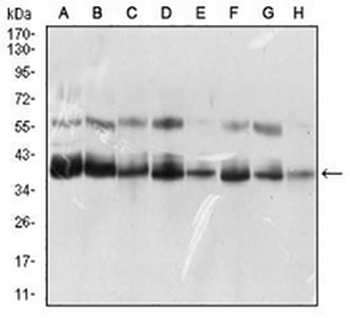 SLM-1 Mouse Monoclonal Antibody