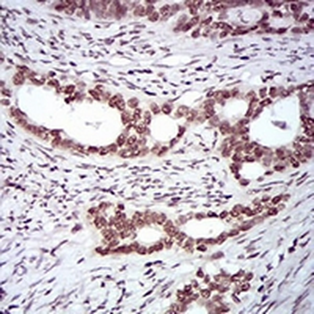 SLM-1 Mouse Monoclonal Antibody