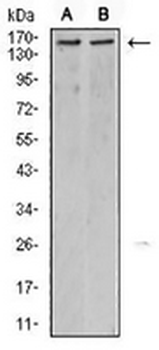 KDM6A Mouse Monoclonal Antibody