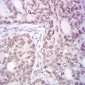 KDM1A Mouse Monoclonal Antibody