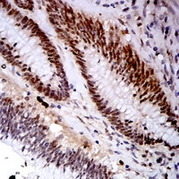 KDM1A Mouse Monoclonal Antibody