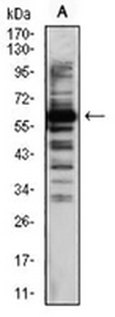 TIP60 Mouse Monoclonal Antibody