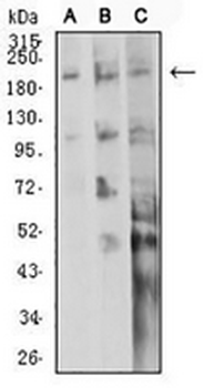 CD104 Mouse Monoclonal Antibody