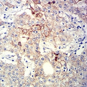 CD104 Mouse Monoclonal Antibody