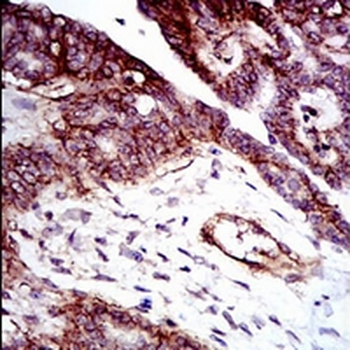 CD29 Mouse Monoclonal Antibody