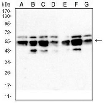 IRF3 Mouse Monoclonal Antibody