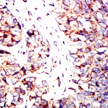 IRF3 Mouse Monoclonal Antibody