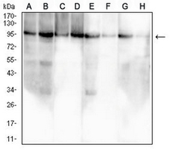 Insulin Receptor Mouse Monoclonal Antibody