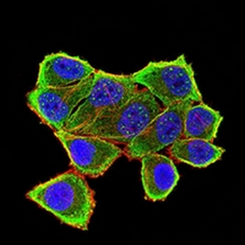 Insulin Receptor Mouse Monoclonal Antibody