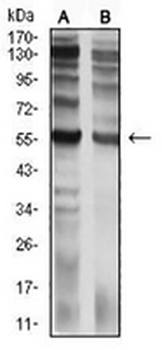 CD129 Mouse Monoclonal Antibody