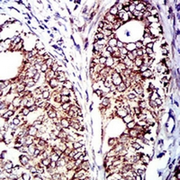 CD129 Mouse Monoclonal Antibody
