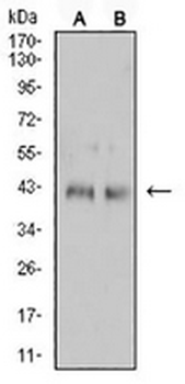 CD132 Mouse Monoclonal Antibody