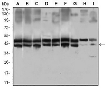 CD25 Mouse Monoclonal Antibody