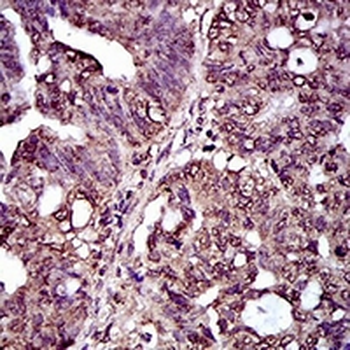 CD25 Mouse Monoclonal Antibody