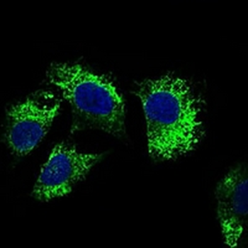 CD25 Mouse Monoclonal Antibody