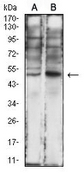 IL-1R2 Mouse Monoclonal Antibody