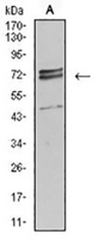 IL-1R1 Mouse Monoclonal Antibody