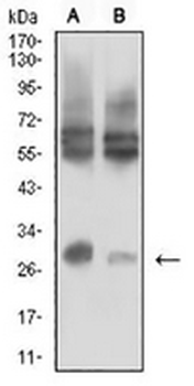 CD215 Mouse Monoclonal Antibody