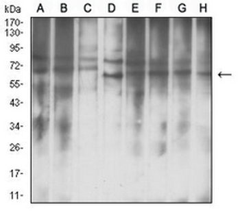 IGF2BP3 Mouse Monoclonal Antibody
