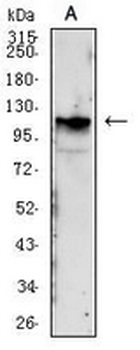 IGF1 Receptor Mouse Monoclonal Antibody