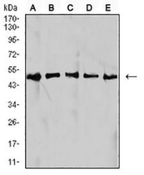 IDH1 Mouse Monoclonal Antibody