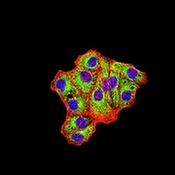 IDH1 Mouse Monoclonal Antibody