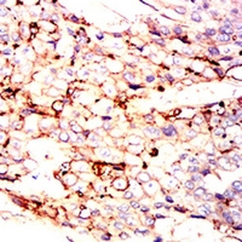 CD54 Mouse Monoclonal Antibody