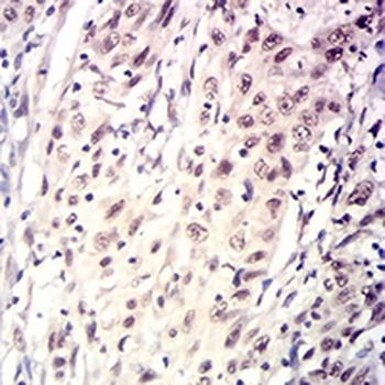 OMI Mouse Monoclonal Antibody