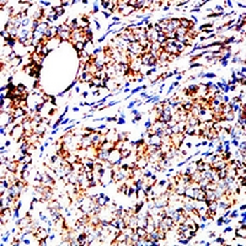 GRP75 Mouse Monoclonal Antibody